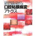 口腔粘膜病変アトラス