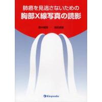 肺癌を見逃さないための胸部Ｘ線写真の読影 / 畠中　陸郎　著 | 京都 大垣書店オンライン