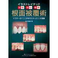 イラストレイテッド安全・安心・確実　根面被覆術　ドクターの「ここが知りたかった！」が満載 / 松井　徳雄　著 | 京都 大垣書店オンライン