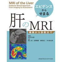 エビデンスからせまる肝のＭＲＩ　撮像から診断まで / 本杉宇太郎 | 京都 大垣書店オンライン