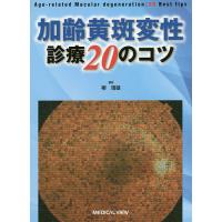 加齢黄斑変性診療20のコツ/柳靖雄 | bookfan