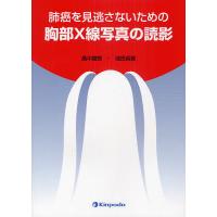 肺癌を見逃さないための胸部X線写真の読影/畠中陸郎/池田貞雄 | bookfan
