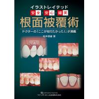 イラストレイテッド安全・安心・確実 根面被覆術 ドクターの「ここが知りたかった!」が満載/松井徳雄 | bookfan