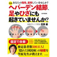 そのヘバーデン結節、足やひざにも起きていませんか? あなたの指先、変形していませんか? | ぐるぐる王国DS ヤフー店