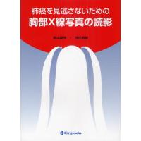 肺癌を見逃さないための胸部X線写真の読影 | ぐるぐる王国DS ヤフー店