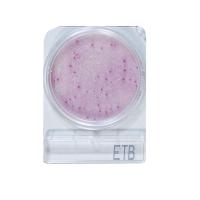 日水製薬 コンパクトドライ? ETB(腸内細菌科細菌群数測定用) 4枚×10袋 06535 1箱(4枚×10袋入) | ホームセンタードットコム