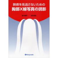 肺癌を見逃さないための胸部X線写真の読影 | ぐるぐる王国 ヤフー店