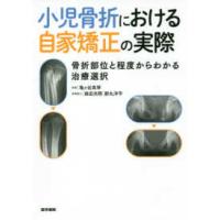 小児骨折における自家矯正の実際 - 骨折部位と程度からわかる治療選択 | 紀伊國屋書店