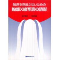 肺癌を見逃さないための胸部Ｘ線写真の読影 | 紀伊國屋書店Yahoo!店