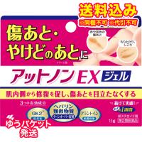 ゆうパケット）【第2類医薬品】アットノンＥＸ　ジェル　15g | くすりのレデイハートショップnice