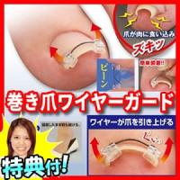 クーポン配布中 巻き爪ワイヤーガード 矯正 器具 ロボ ブロック ワイヤー 痛い 手術 爪切り ニッパー 皮膚科 治療 痛い ズキズキ 足の爪 食い込み Wat41 エスケンショッピング 通販 Yahoo ショッピング