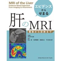 本杉宇太郎 エビデンスからせまる 肝のMRI 撮像から診断まで Book | タワーレコード Yahoo!店