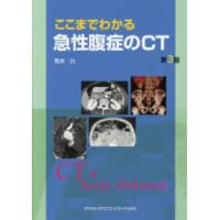 ここまでわかる急性腹症のCT 第3版 : 有隣堂ヤフーショッピング店