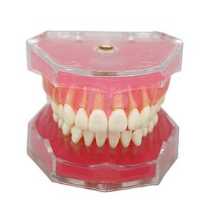 Romantic桜 歯列模型 上下顎180度開閉式 義歯モデル 歯茎が柔らかい 歯磨き 指導 研究 説明用 標準教学模型 脱着可能 高品質の商品画像