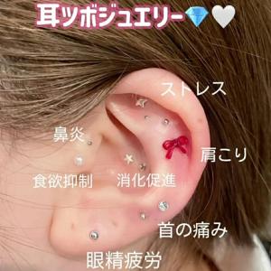 耳つぼシール 粒タイプ 金属アレルギー対応 ス...の詳細画像3