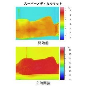スーパーメディカルマット全身用の詳細画像3