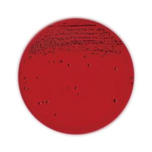 BD BBL TM アネロコロンビアRS血液寒天培地 10枚 ベクトン