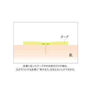 アトレスケア 傷跡ケア専用テープ 50×50m...の詳細画像3