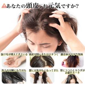 ヘッドスパ 頭皮マッサージ ヘッドマッサージ ...の詳細画像2