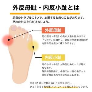 外反母趾 サポーター 内反小趾 4個セット 矯...の詳細画像3