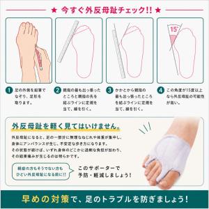 外反母趾グッズ ソルボ 外反母趾 内反小趾 サ...の詳細画像2