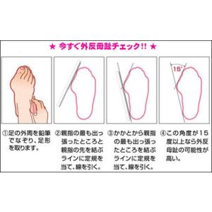 外反母趾 グッズ ソルボ 外反母趾サポーター ...の詳細画像2