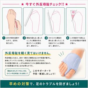 外反母趾 グッズ ソルボ 外反母趾サポーター ...の詳細画像2