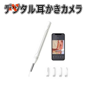 耳かき カメラ 極細 USB充電 WIFI接続 イヤースコープ 無線 LEDライト付き IP67防水 耳掃除 耳鏡 耳垢クリーニング iphone＆Android対応 使用簡単 1ヶ月保証の商品画像