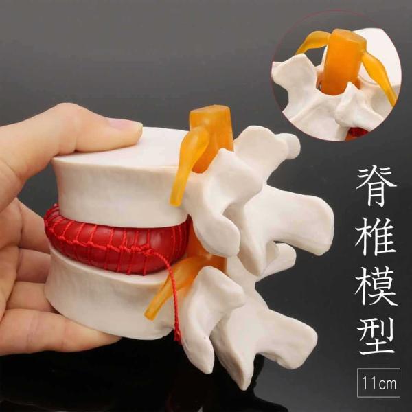 人体模型 脊椎 骨 腰椎 脊髄 実物大模型 実物大男性骨盤 脊柱可動 ヘルニア病部 脊髄神経根 椎骨...