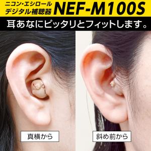 補聴器両耳用 耳穴式 ニコン・エシロール NE...の詳細画像2