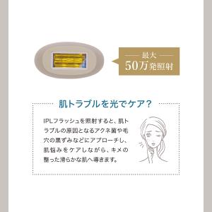 LINKA リンカ エピゼロ IPL 光美容器...の詳細画像5