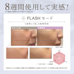美顔器 光美容器 LINKA リンカ スノー ...の詳細画像3