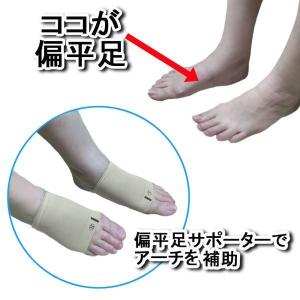 偏平足 サポーター 足 保護 横アーチ シリコ...の詳細画像4