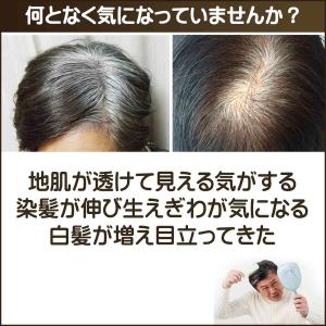 白髪かくし 頭皮用ファンデーション 白髪隠し ...の詳細画像1