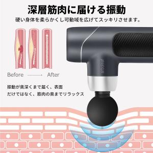 arboleaf 筋膜リリースガン J2 MI...の詳細画像5