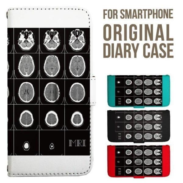 らくらくスマートフォン カバー らくらくホン ユニーク MRI らくらくスマホ me f42a f0...