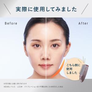 全額返金保証 スカルプ 電気ブラシ 女性用 育...の詳細画像3