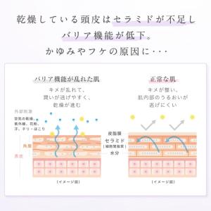 スカルプDボーテ 頭皮保湿美容液 2本 頭皮 ...の詳細画像2