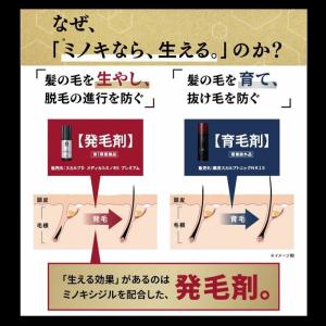 第1類医薬品 発毛剤 ミノキシジル メディカル...の詳細画像3