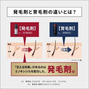 第1類医薬品 発毛剤 ミノキシジル AGA治療...の詳細画像3