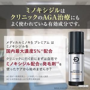 第1類医薬品 発毛剤 ミノキシジル AGA治療...の詳細画像4