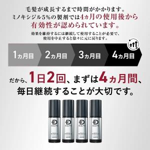 公式店 第1類医薬品 発毛剤 ミノキシジル 単...の詳細画像3