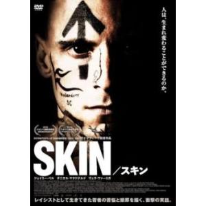 SKIN スキン レンタル落ち  DVD