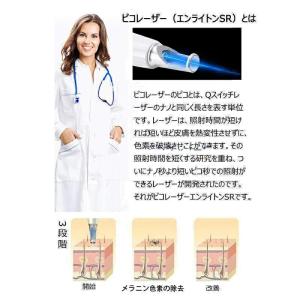 美顔器 ピコレーザー 美顔器 ほくろそばかす除...の詳細画像2