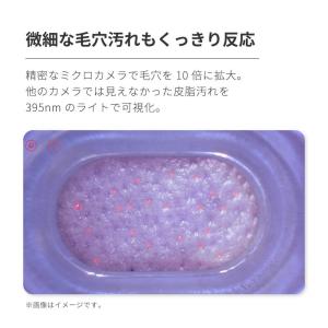 毛穴吸引器 スマホ連動 カメラ付き Areti...の詳細画像3