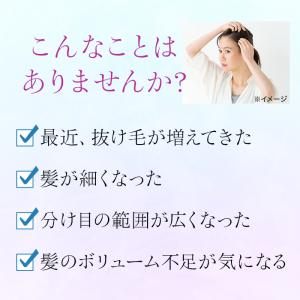 第1類医薬品 アートネイチャー 発毛剤 育毛剤...の詳細画像3