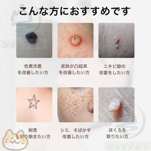 ピコレーザー 美顔器 レーザーペン シミ取り ...の詳細画像4