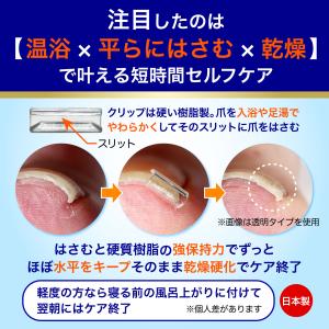 巻き爪クリップ 硬質樹脂特殊形状 平らに強力保...の詳細画像3