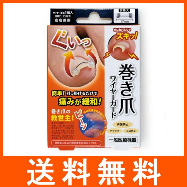 巻き爪ワイヤーガード