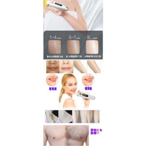 光脱毛器 最新型 女性 メンズ 軽量 人気 光...の詳細画像5